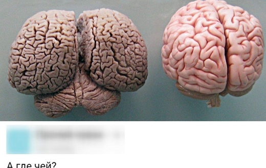 Мозг дельфина и человека